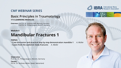 CMF Trauma Webinar Series: Module 10 now available in our Virtual Campus