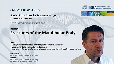 CMF Trauma Webinar Series: Module 5 now available in our Virtual Campus