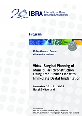 Virtual Surgical Planning of Mandibular Reconstruction Using Free Fibular Flap with Immediate Dental Implantation - Overview 1