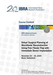 Virtual Surgical Planning of Mandibular Reconstruction Using Free Fibular Flap with Immediate Dental Implantation - Overview 1